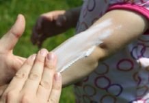 Recomendaciones para cuidar tu piel del sol